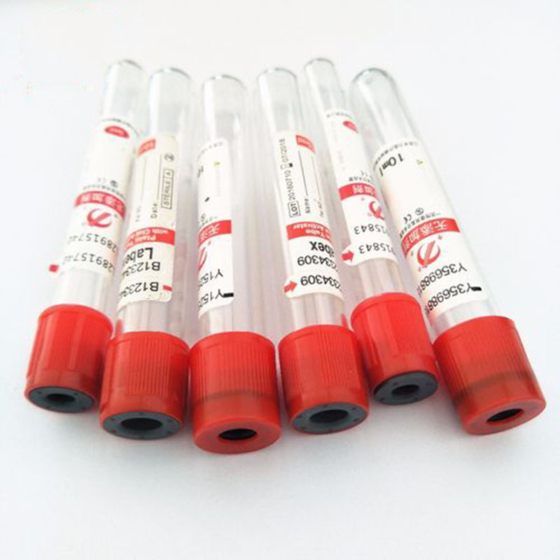 100 sztuk/partia 3ml 5ml 10ml  – Blood Collection Tube recenzja i cena